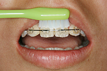 歯磨き01