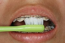 歯磨き02